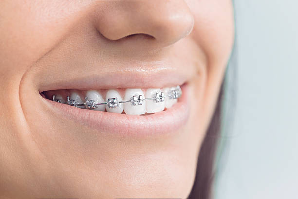 Dental Inlays and Onlays in Linda, CA